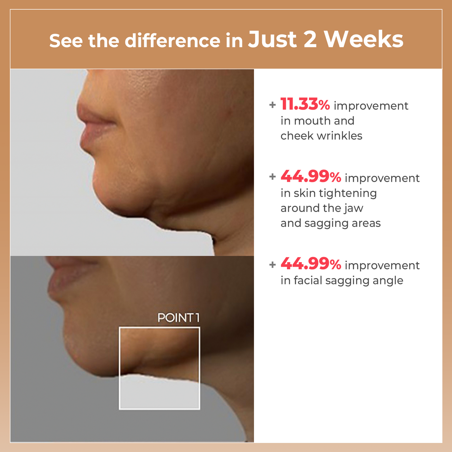 AALOK FITSERA - Precision LED Lifter